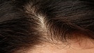 Der Haaransatz einer Frau mit dunklen Haaren. | Bild: colourbox.com