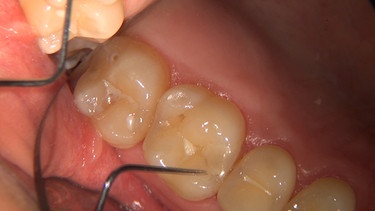 Beim Zahnarzt. | Bild: BR