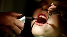 Junge beim Zahnarzt  | Bild: picture-alliance/dpa
