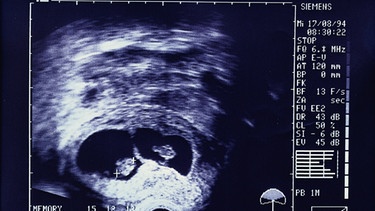 Ein Ultraschallbild zeigt in der Gebärmutter zweiige Zwillinge im Alter von sieben Wochen. | Bild: picture-alliance / OKAPIA KG