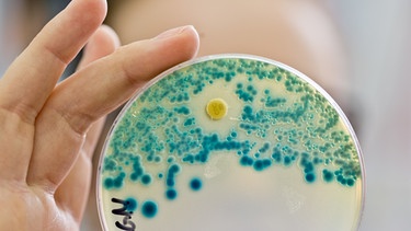 Forschung Antibiotika - Multiresistente Keime | Bild: picture-alliance/dpa