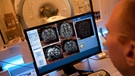 Ein Laborant sitzt in der Uniklinik Großhadern in München (Oberbayern) vor einem Bildschirm mit Aufnahmen eines MRT vom Gehirn des Probanden, der im Hintergrund im MRT-Gerät liegt.  | Bild: picture alliance / dpa | Andreas Gebert