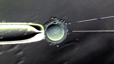 Im Biologischen Labor des Zentrums für Reproduktionsmedizin an der Universitätsfrauenklinik in Leipzig ist eine 80- bis 100-fache Vergrößerung der Befruchtung einer Eizelle mit einer Injektionspipette zu sehen. | Bild: picture-alliance/dpa
