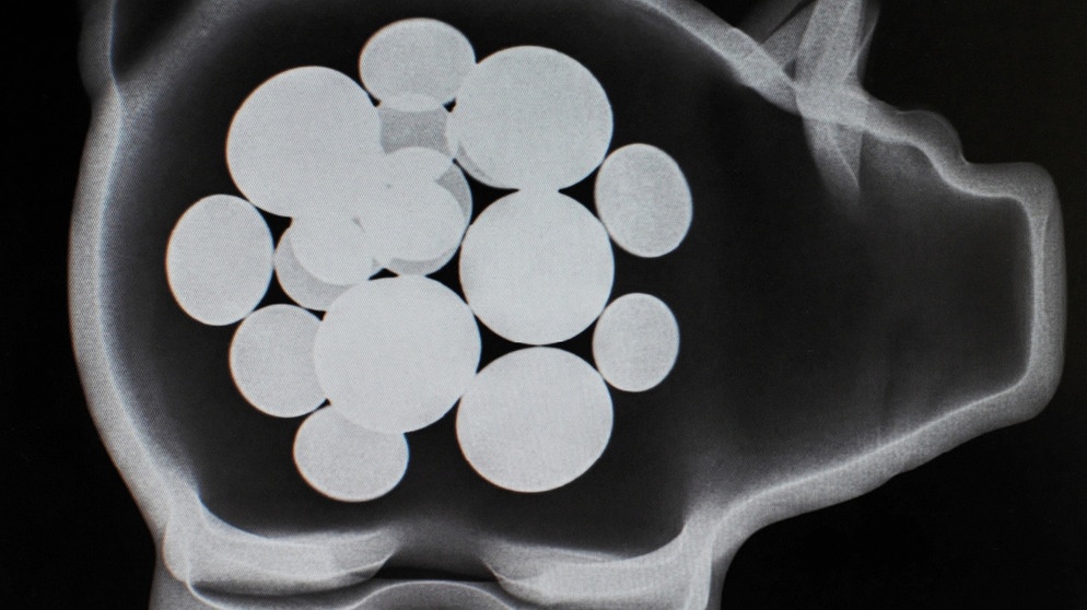 Röntgenbild Sparschwein mit Münzen im Inneren | Bild: picture-alliance/dpa