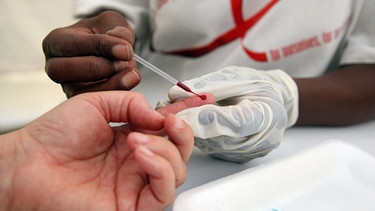 An executive from South Africa's largest commercial bank, Standard Bank, undergoes an HIV test during an HIV/AIDS awareness drive on World AIDS Day in Johannesburg, South Africa | Bild: picture-alliance/dpa
