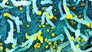 Vom Corona-Virus attackierte Zellen eines menschlichen Körpers unter dem Mikroskop | Bild: picture-alliance/dpa