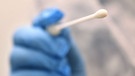 Ein Arzt hält in einer Hausarztpraxis einen Tupfer mit dem ein Abstrich für einen Coronatest gemacht wird.  | Bild: dpa-Bildfunk / Karl-Josef Hildenbrand