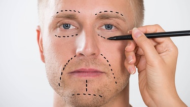 Mit einem Filzstift werden Linien auf dem Gesicht eines Mannes gezogen, anhand denen operiert werden soll. | Bild: picture-alliance/dpa