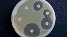 MRSA-Keime sind in einer Petrischale zu sehen. Die weißen Plättchen geben verschiedene Antibiotika ab, von denen einige die Keime im Umkreis absterben lassen. | Bild: picture-alliance/dpa