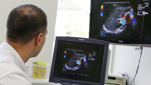 Ein Arzt blickt auf Ultraschallmonitore. | Bild: Klinikum rechts der Isar/Michael Stobrawe