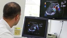 Ein Arzt blickt auf Ultraschallmonitore. | Bild: Klinikum rechts der Isar/Michael Stobrawe