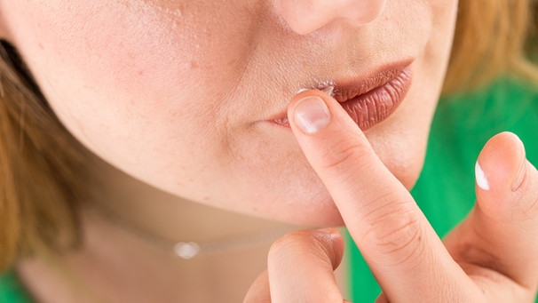 Eine Frau gibt mit dem Finger Salbe auf eine Stelle an ihrer Lippe | Bild: picture-alliance/dpa