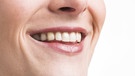 Eine Frau lächelt und zeigt dabei ihre Zähne. | Bild: adpic/M. Baumann