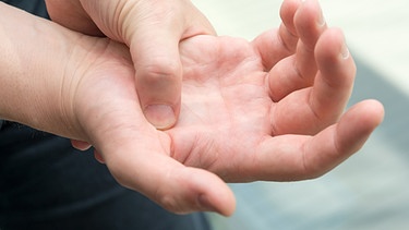Mann hält sich schmerzende Hand. | Bild: picture-alliance/dpa
