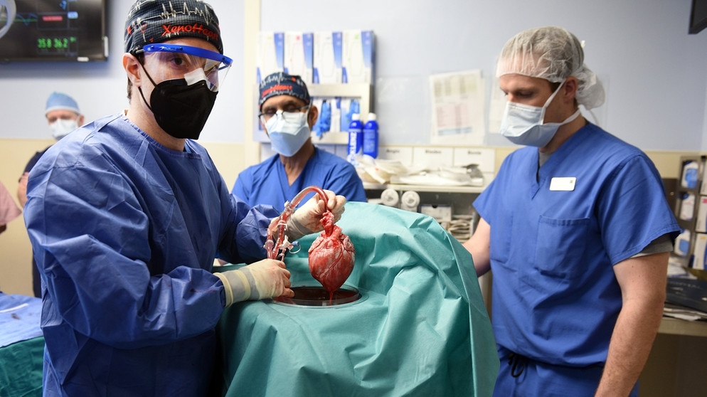 07.01.2022, USA, Baltimore: Ärzte operieren an einem Schweineherz das in einen menschlichen Patienten eingesetzt wird. | Bild: Tom Jemski/University of Maryland School of Medicine/dpa +++ dpa-Bildfunk +++