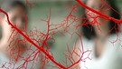 Transparent gemachte Blutgefäße | Bild: picture-alliance/dpa