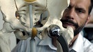 Künstiches Hüftgelenk demonstriert am menschlichen Skelett | Bild: picture-alliance/dpa