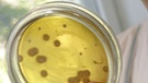 Urin mit Hepatitis-A-Zellen in einer Petrischale | Bild: picture-alliance/dpa