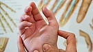 Die sog. Sattelgelenksathrose ist eine häufige Form der Gelenksarthrose in der Hand. Im Bild: Eine Hand wird therapiert. | Bild: picture-alliance/dpa