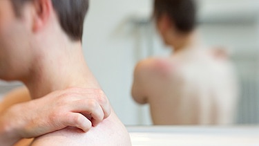 Typisches Symptom der Nesselsucht ist ein roter Hautausschlag, der meist stark juckt. Im Bild: Junger Mann kratzt sich am Rücken. | Bild: picture-alliance/dpa