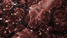 Mikroskopansicht Blut, bearbeitet. | Bild: Colourbox.com / Zhukovskyi Serhii  / Montage BR