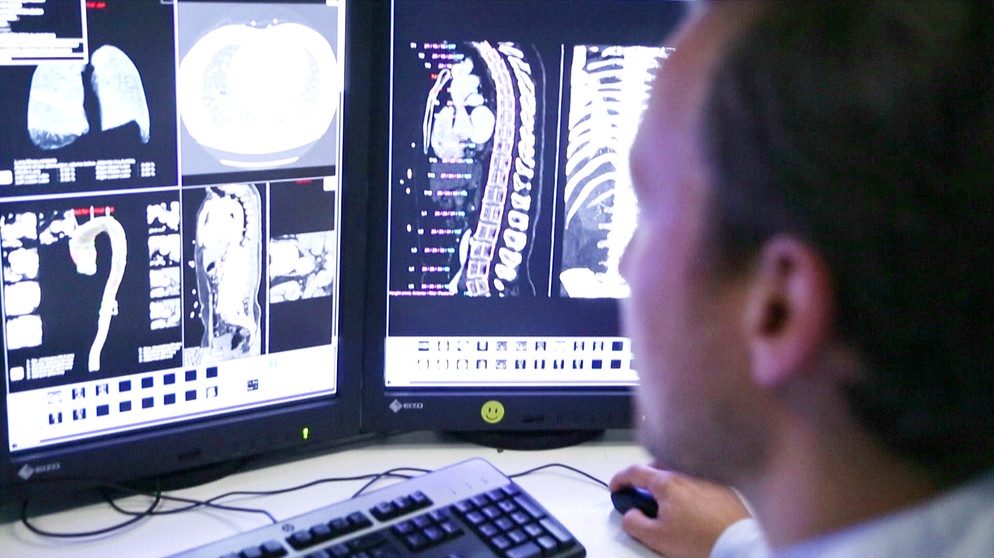 Jemand sitzt am Computer und schaut auf einen Bildschirm mit Röntgenaufnahmen von verschiedenen Organen und Knochen | Bild: BR