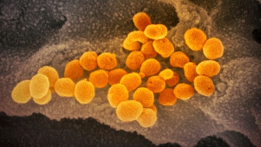 Coronavirus unter dem Elektronenmikroskop | Bild: NIAID-RML/AP/dpa -Bildfunk