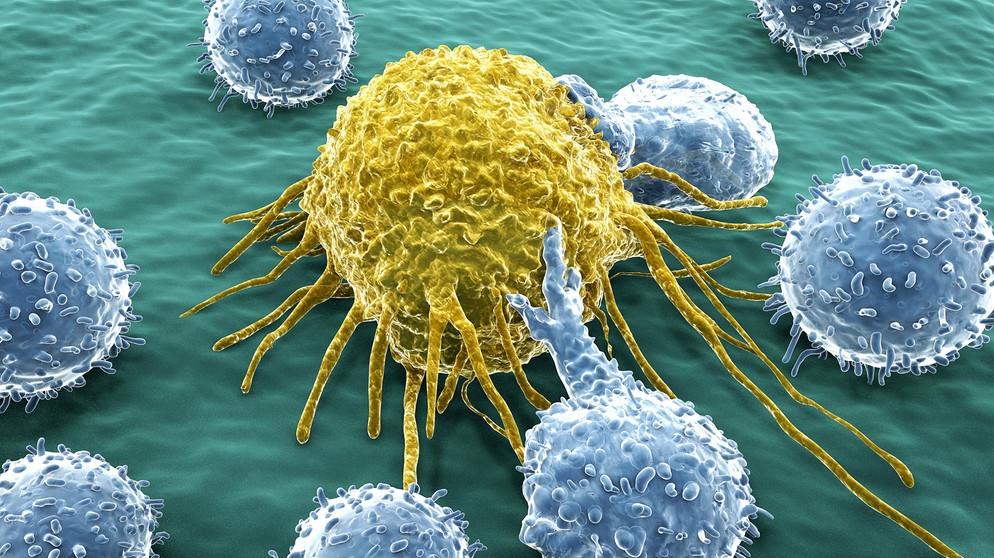 Illustration einer Krebszelle, die von Lymphozyten angegriffen wird. Immuntherapie soll das körpereigene Immunsystem dabei stärken, Krebs zu bekämpfen | Bild: Adobe Stock / Juan Gärtner
