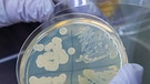 Laboratorin hält eine Probe mit E. coli-Bakterien in den Händen. | Bild: picture-alliance/dpa