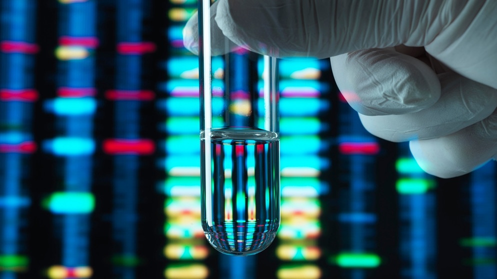 Symbolbild: Genforschung, Reagenzglas vor einem DNA-Profil
| Bild: picture-alliance/dpa