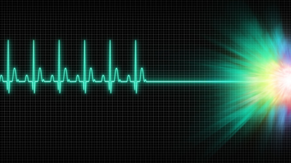 Kurve einer stehengebliebenen Herzfrequenz mit bunten Lichtern am Ende. | Bild: colourbox.com