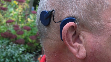 Cochlea Implantat | Bild: picture-alliance/dpa