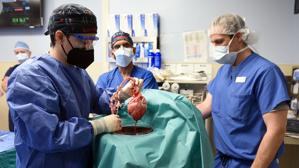 Chirurgenteam mit dem ersten Schweineherz, das einem Menschen transplantiert werden soll. Am 7. Januar 2022, Baltimore, USA | Bild: picture-alliance/dpa
