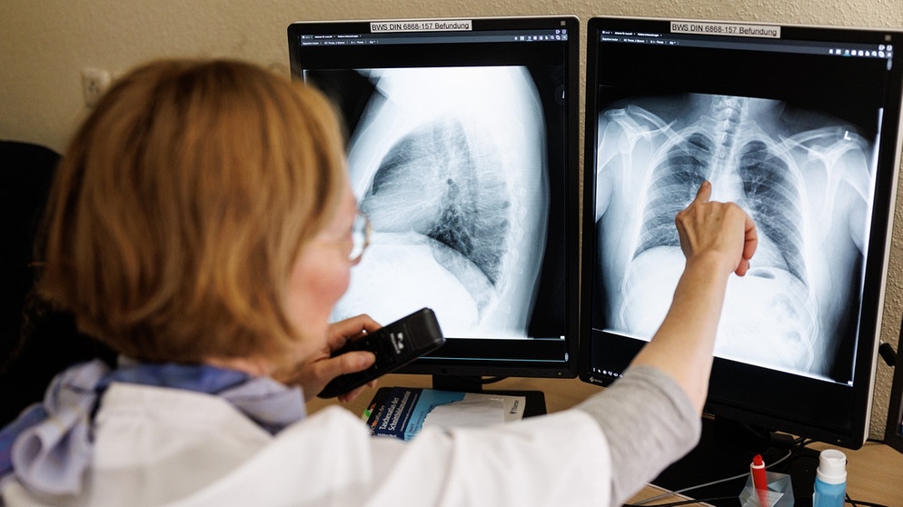 Eine Radiologin analysiert Röntgenbilder einer Lunge | Bild: picture-alliance/dpa