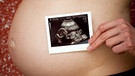 Nackter Bauch einer Schwangeren mit Ultraschallbild | Bild: picture-alliance/dpa