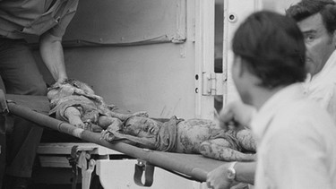 Verletzte Kinder im Vietnam-Krieg | Bild: picture-alliance/dpa