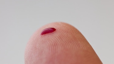 Blutstropfen auf Fingerkuppe | Bild: picture-alliance/dpa