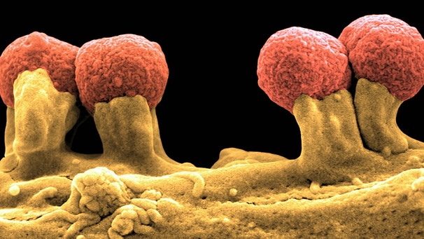 Krankheitserregendes Darmbakterium | Bild: picture-alliance/dpa