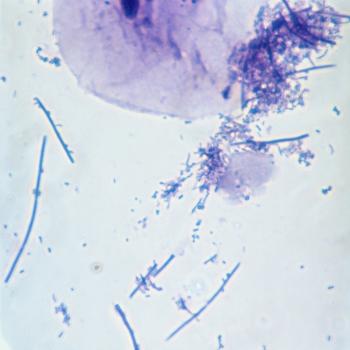 Bakterien im Zahnbelag | Bild: picture-alliance/dpa