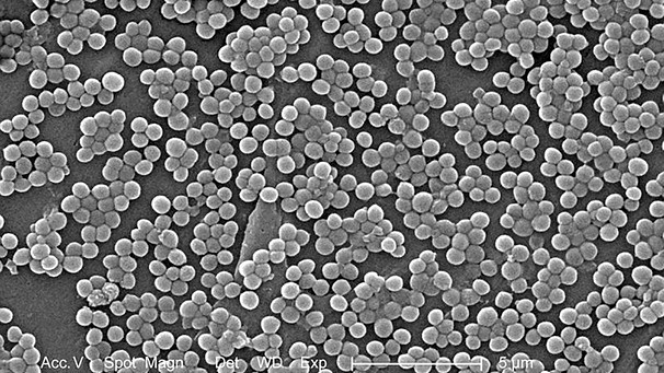 Bakterium Staphylococcus aureus im Elektronenmikroskop | Bild: picture-alliance/dpa