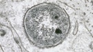 neurophilen Granulozyten mit Bakterien | Bild: picture-alliance/dpa