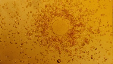 Mikroaufnahme einer menschlichen Eizelle | Bild: picture-alliance/dpa
