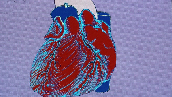Herz mit Herzkranzgefäßen, Hohlvene, Pulmonalarterie und Aortenbogen, Aorta mit Herzkranzgefäßen als Computergrafik | Bild: picture-alliance/dpa