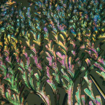 Mikroskopische Aufnahme von Penizillin in polarisiertem Licht, Maßstab 400:1 | Bild: picture-alliance/dpa