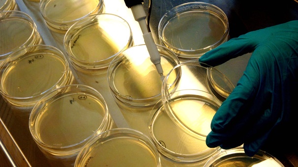 Nährböden werden mit genmanipulierten Pilzzellen geimpft | Bild: picture-alliance/dpa