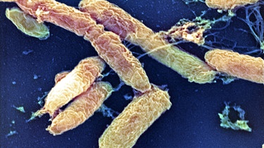 Pest-Erreger "Yersinia pestis" unter dem Rasterelektronen-Mikroskop | Bild: picture-alliance/dpa