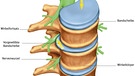 Die Illustration zeigt die Lage der Bandscheibe zwischen den Rückenwirbeln | Bild: picture-alliance/dpa