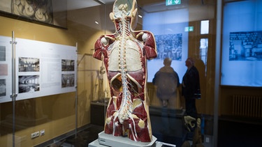 Ein bemaltes Gipsmodell des menschlichen Rückens | Bild: picture-alliance/dpa