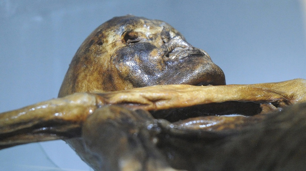 Gletschermumie Ötzi  | Bild: picture-alliance/dpa