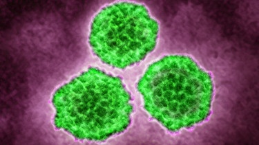 Humane Papillomaviren unter dem Mikroskop. | Bild: picture-alliance/dpa